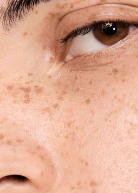 vichy normaderm