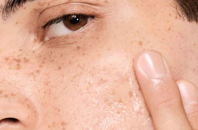 vichy normaderm