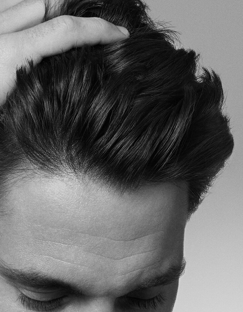 everything-you-need-to-know-about-adherent-dandruff